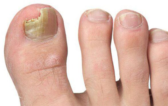 Różne formy grzybów