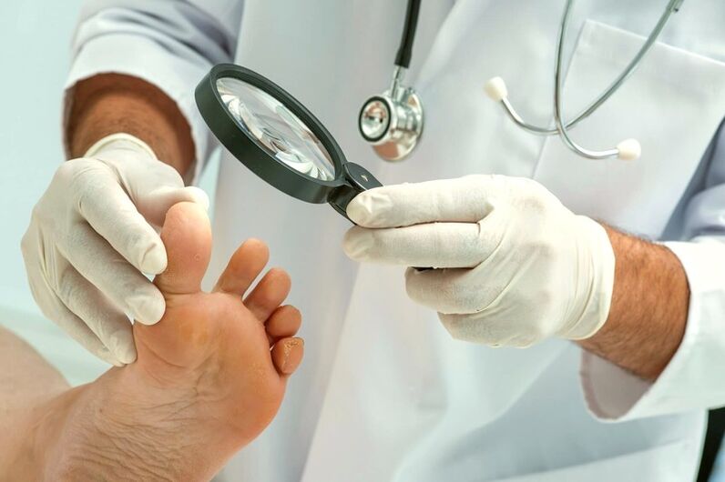 Dermatolog bada paznokcie u nóg