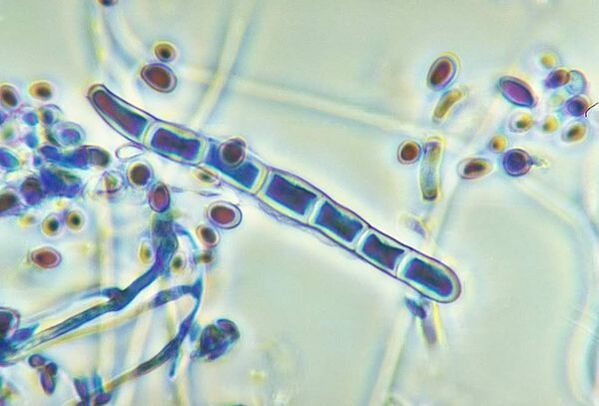 Grzyb Trichophyton rubrum pod mikroskopem